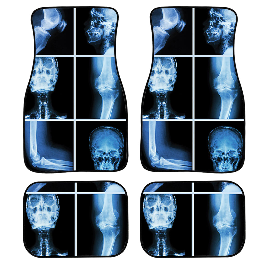 X-Ray Film Radiology Print Front And Back Car Floor Mats/ Front Car Mat