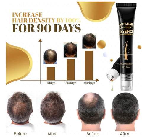 Biotin Haarwuchs Roll-On Massage-Essenz