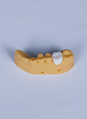 Dental Crown & Bridge Model