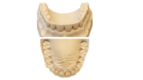 The Best Dental orthodonticRestoration Model Resin from China Dental UV Resin Original Manufacturer Purple Dance