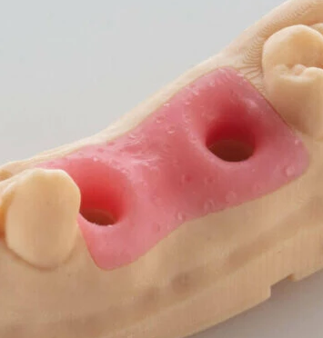 The Best Dental Gingival Masks Model Resin from China Dental UV Resin Original Manufacturer Purple Dance