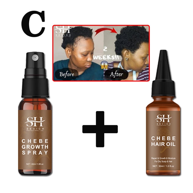 Alopecia Treatment Oil Hair Growth Spray Hair Loss Treatment