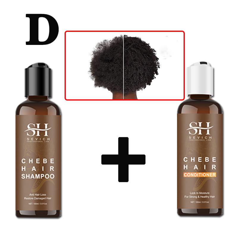 Alopecia Treatment Oil Hair Growth Spray Hair Loss Treatment