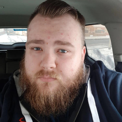 PureVital™ Sleep Apnea Spray