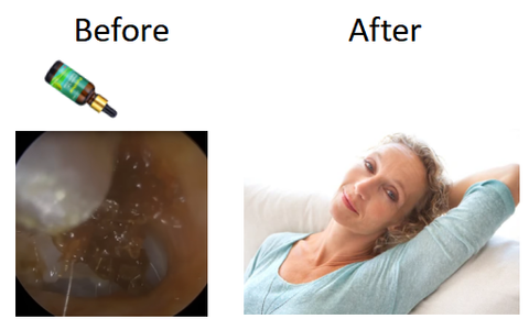 Meellop™ Tinnitus Relief Treatment Care Drops