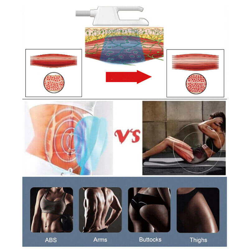 Portable EMSZERO Neo Body Sculpting Machine Treatment Areas