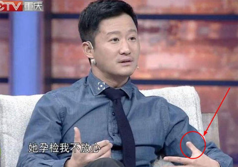 吴京的大拇指少一节