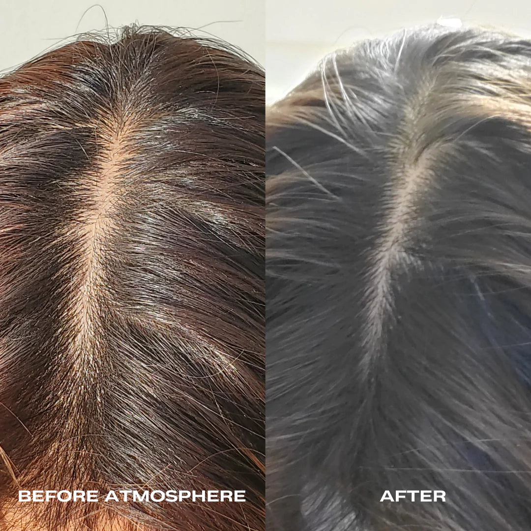 Atmosphere Hair Density & Scalp Serum