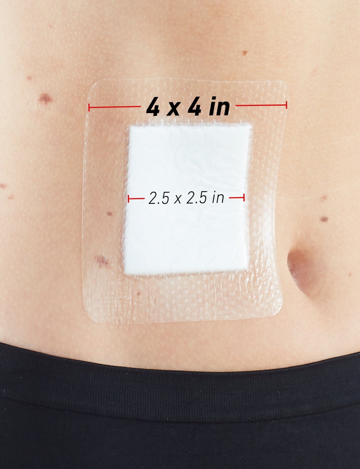 Silicone Multi Purpose Dressing