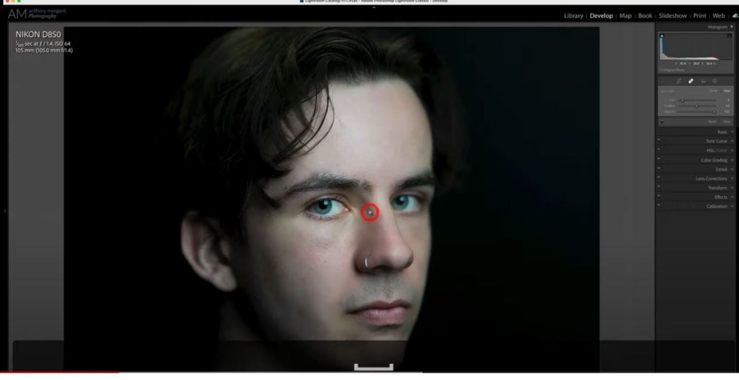 Lightroom tutorial on blood vessels removal