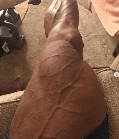 Sadik Hadzovic leg workout