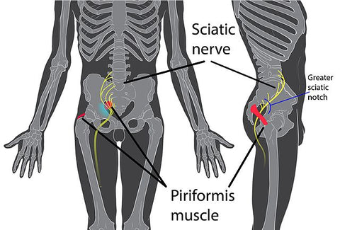 90 Second Exercise to STOP Sciatica & Piriformis Syndrome In Bed