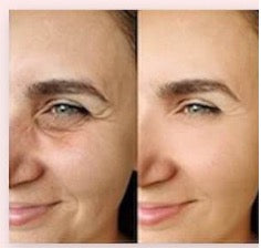 masque facial LED avant et après