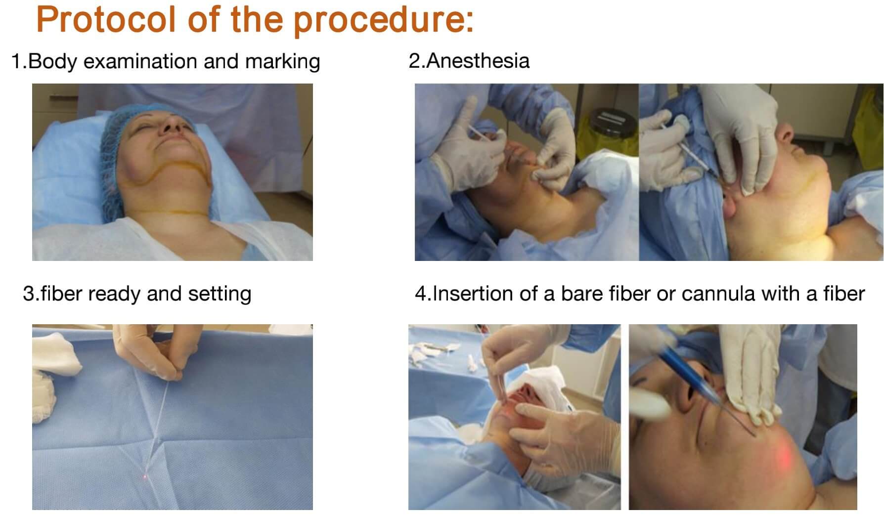 Liposuction Nd YAG Laser 1470nm