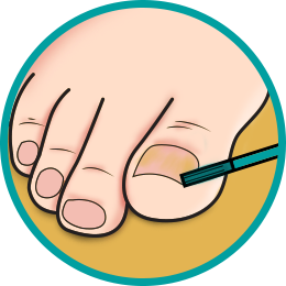 beat nail fungus with emoninail andactive nail penetration