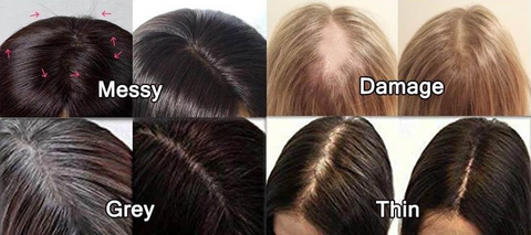 sunny hair topper for thin hair sunny hair extensions