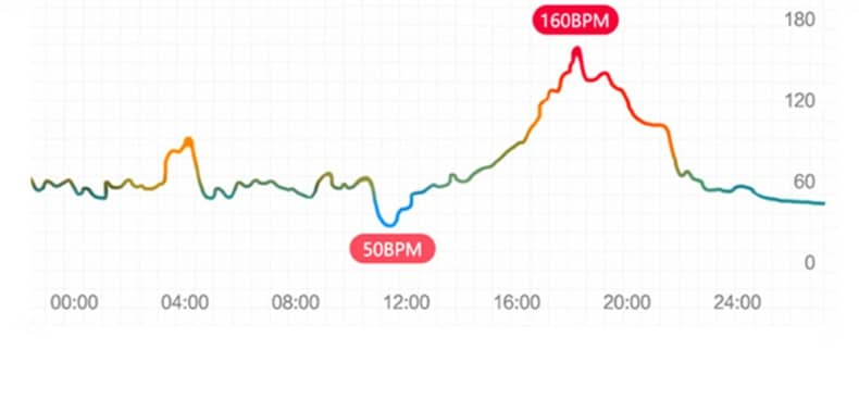 Reloj inteligente Findtime, monitor de presión arterial, temperatura corporal, oxígeno en sangre, frecuencia cardíaca con llamadas Bluetooth