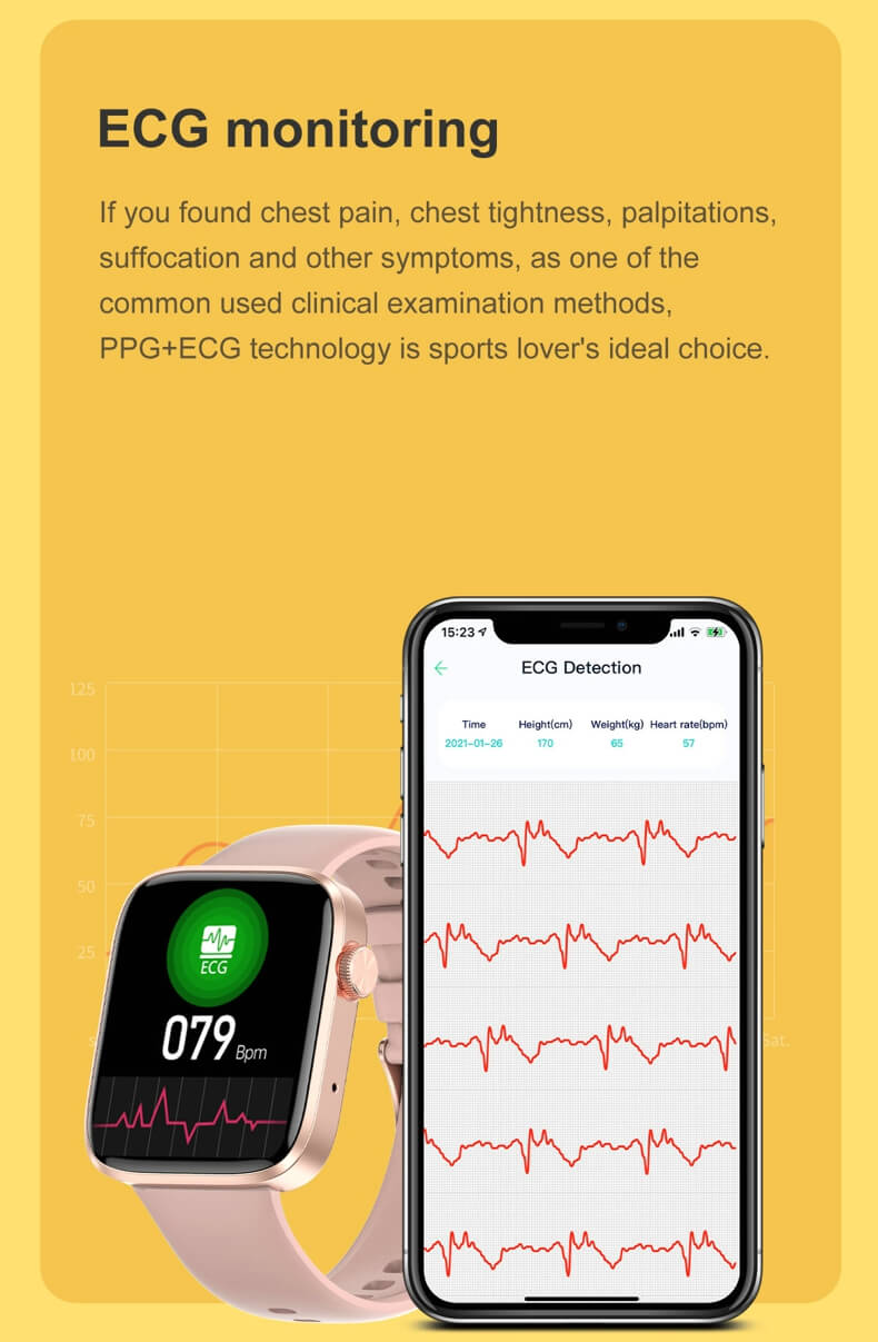 Reloj inteligente Findtime ECG con monitor de frecuencia cardíaca SpO2 Llamadas Bluetooth