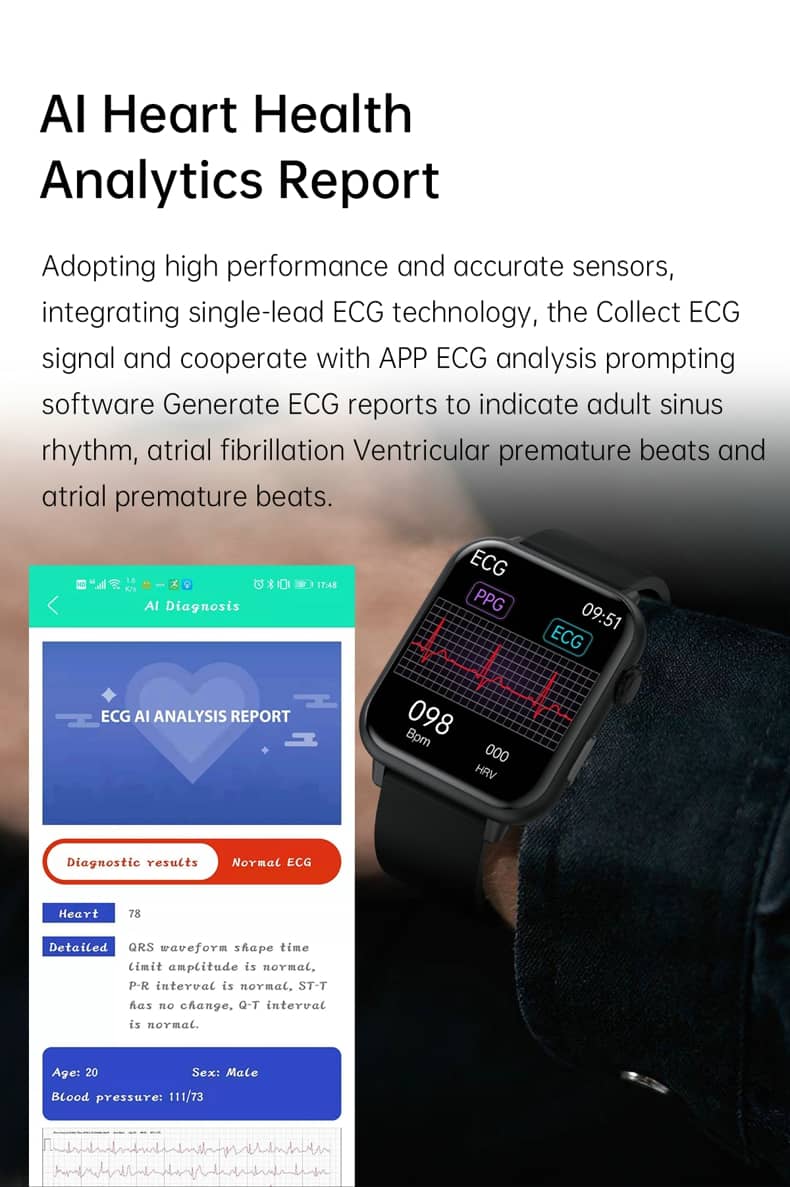 Findtime EKG Smart Watch Blutdruckmessgerät Körpertemperatur Herzfrequenz Blutsauerstoff
