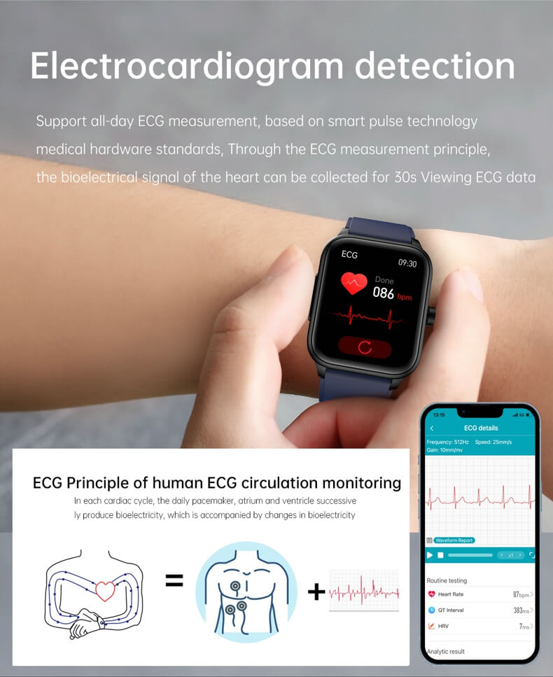 ECG monitoring