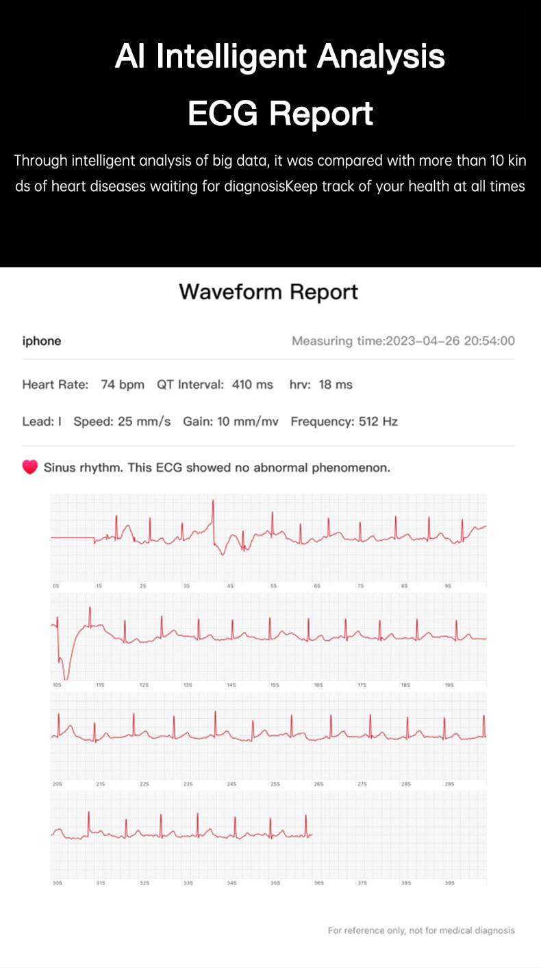 Informe de electrocardiograma