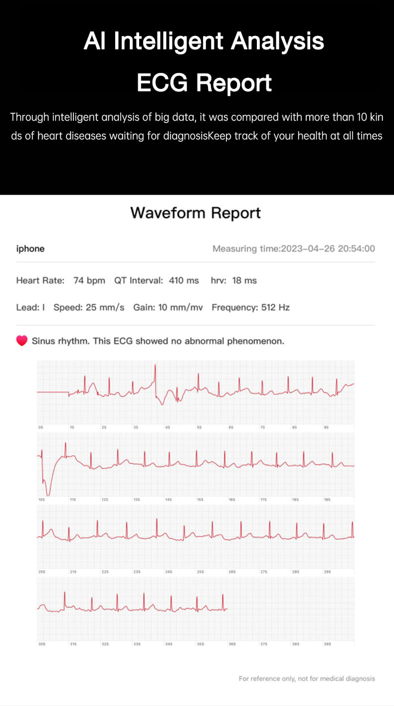 EKG-Bericht