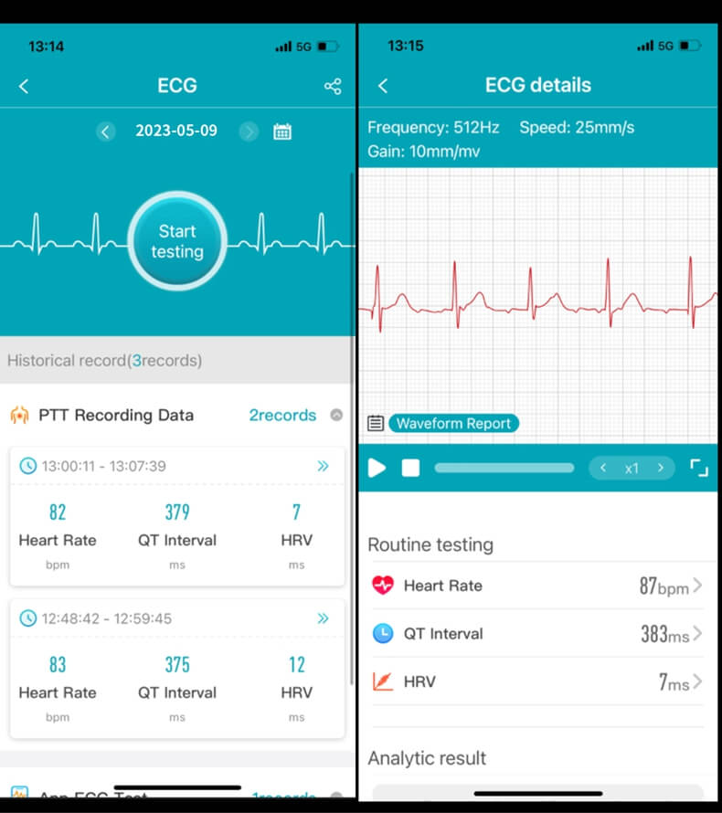 ECG data on app