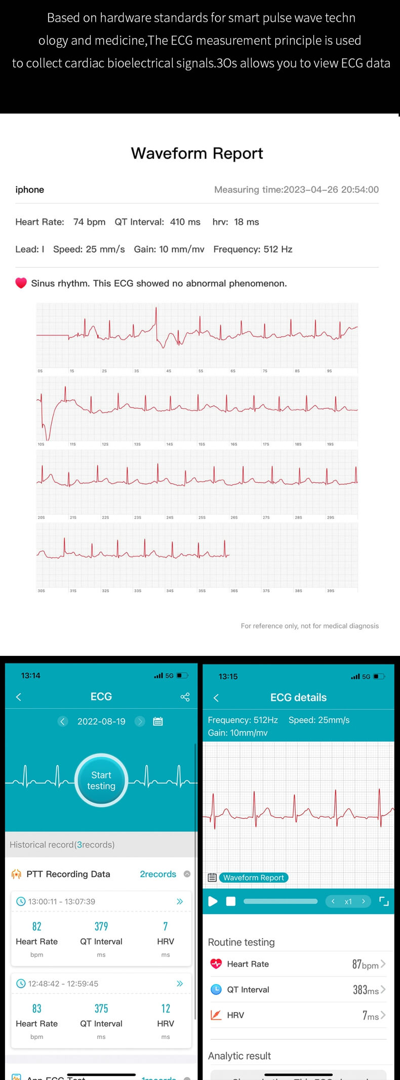 Findtime Smartwatch S56 Monitoreo de ECG