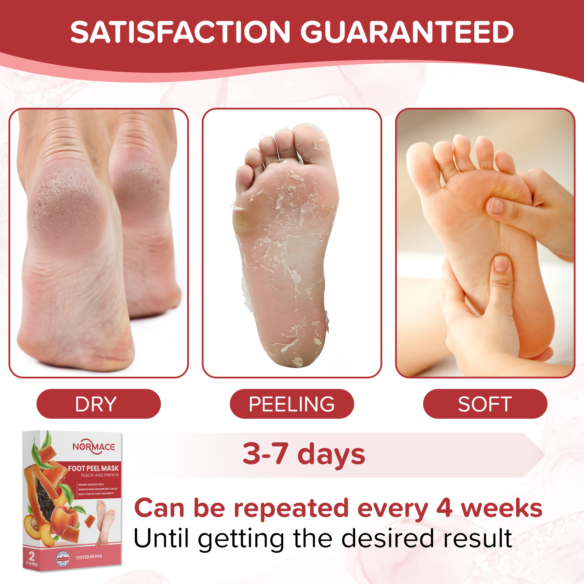 Foot Peel Mask with Peach and Papaya by Normace- 2 Pairs Exfoliating Foot Mask Microbial Tested for Dry, Cracked Feet, Callus & removing dead dry skin for soft baby feet.