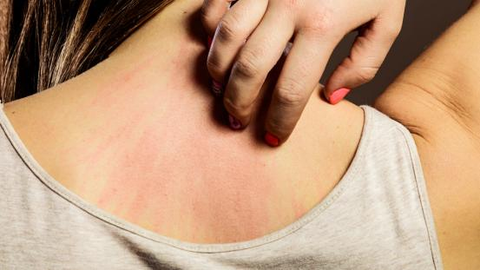 Winter body care tips